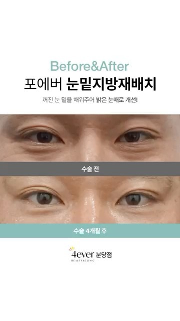 유튜브쇼츠